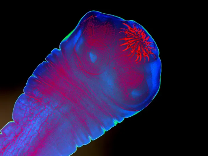 RFK Jr. is controversial (aka crazy AF)